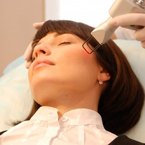 Feldlaserverjüngung