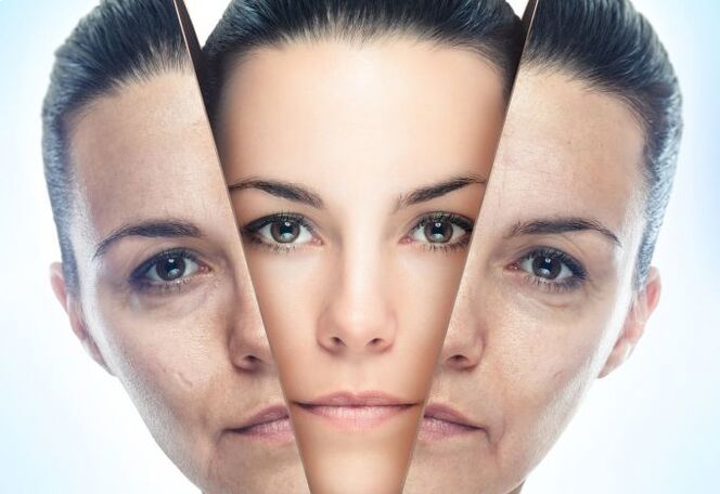 Der Prozess der Beseitigung altersbedingter Veränderungen der Gesichtshaut